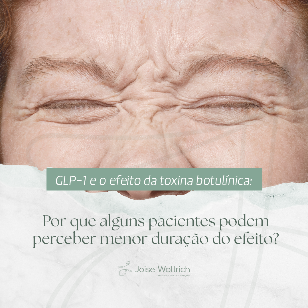 Será que o uso de GLP-1 pode fazer a toxina durar menos?