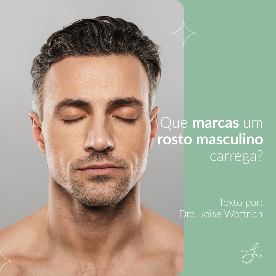 Que marcas um rosto masculino carrega?